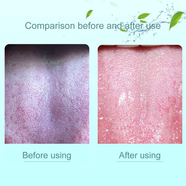 1 Piece Tongue Scraper | Tongue Cleaner