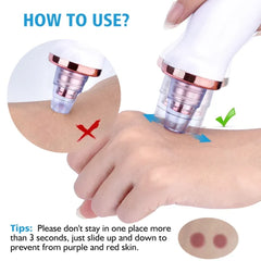 Vacuum Blackhead Remover Face Black Spots Cleaner White Dot Pimple Removal | Blackhead Remover For Nose,facial Pore Acne Grease Cleaner Skin Care